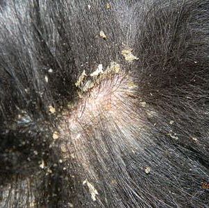 Síntomas de la caspa en los perros