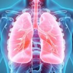 Como Afecta El Covid 19 Al Sistema Respiratorio