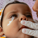 Como Curar El Sarpullido En La Cara De Los Bebes