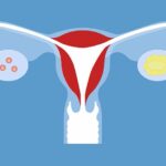 Consejos para estimular la llegada del periodo menstrual naturalmente.