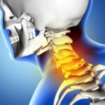 Aliviar el dolor de cuello y hombros: Consejos útiles.