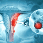 Estado del cuello uterino tras una cauterización: lo que debes saber.