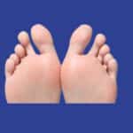 Eliminar la infección del dedo del pie con pus en casa.