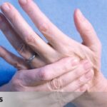 Alivio del dolor en las uñas de las manos: soluciones efectivas.