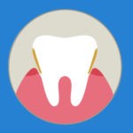 Eliminar el sarro dental sin acudir al dentista: Método efectivo.
